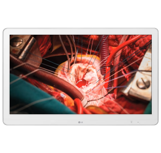 M&agrave;n H&igrave;nh Nội Soi 27HK510S