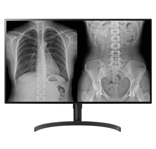 M&Agrave;N H&Igrave;NH CHẨN ĐO&Aacute;N 32HL512D