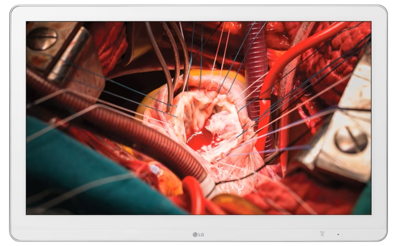 M&agrave;n H&igrave;nh Nội Soi 27HK510S