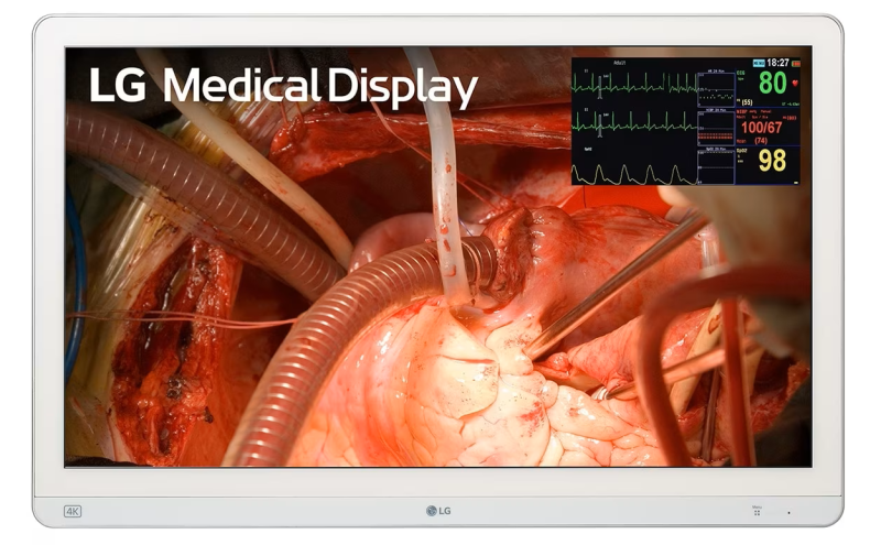 M&agrave;n h&igrave;nh nội soi 27HQ710S